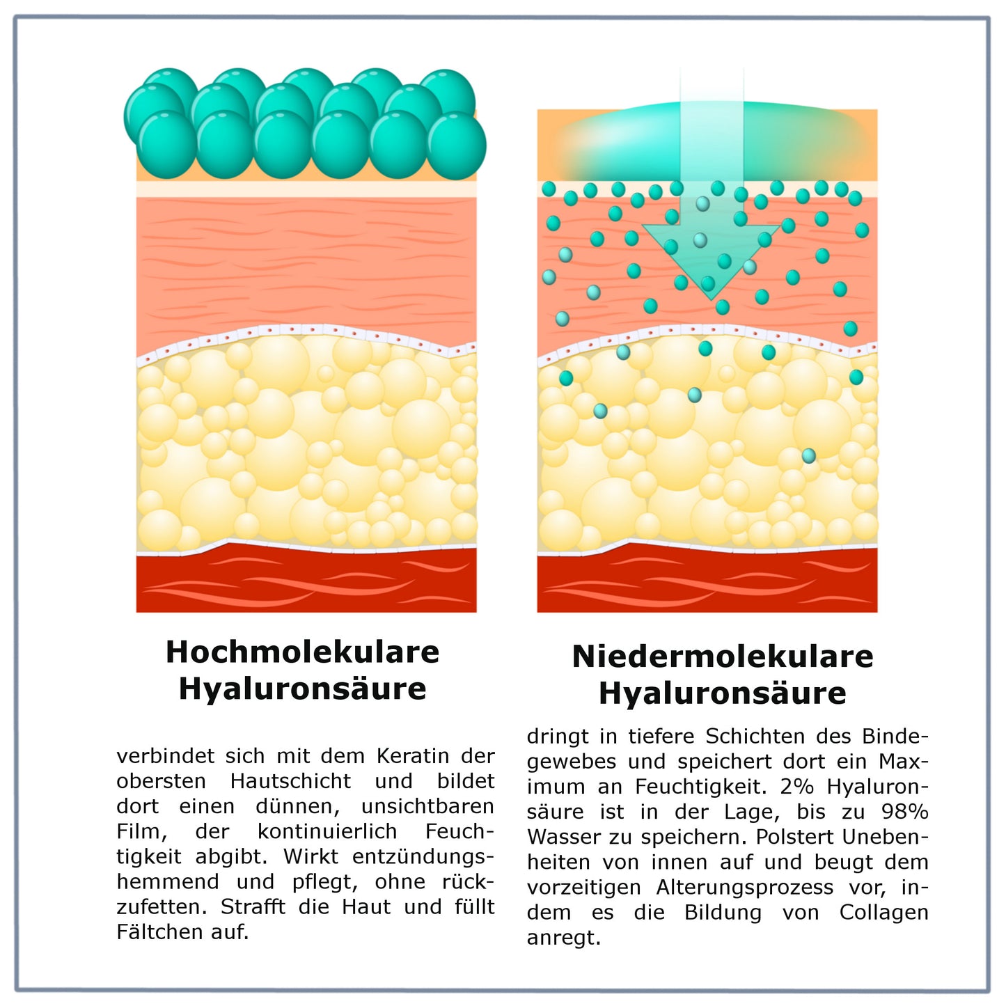 Hyaluronsäure